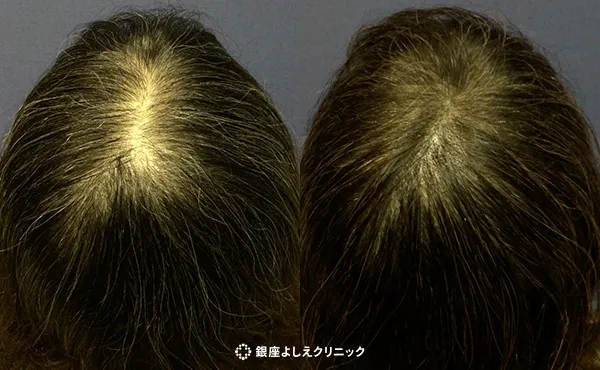 施術前/施術後