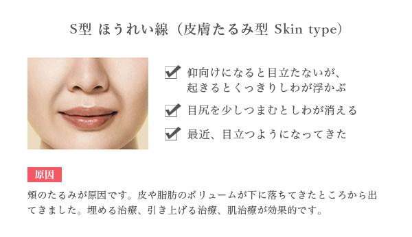 即効型 頬のたるみ ほうれい線 解消治療 美容皮膚科 銀座よしえクリニック