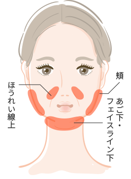 Bnls注射 美容皮膚科 銀座よしえクリニック 公式 東京