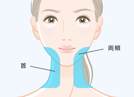 ボトックスリフト