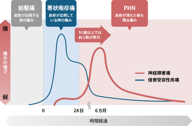 帯状疱疹後神経痛発症グラフ